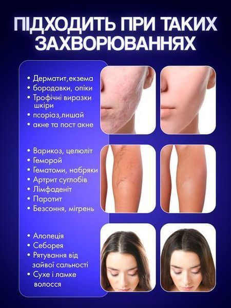 Дарсонваль для волосся та обличчя pbl-066 фото